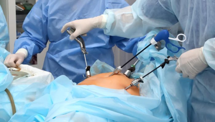Advanced Laparoscopic Surgery